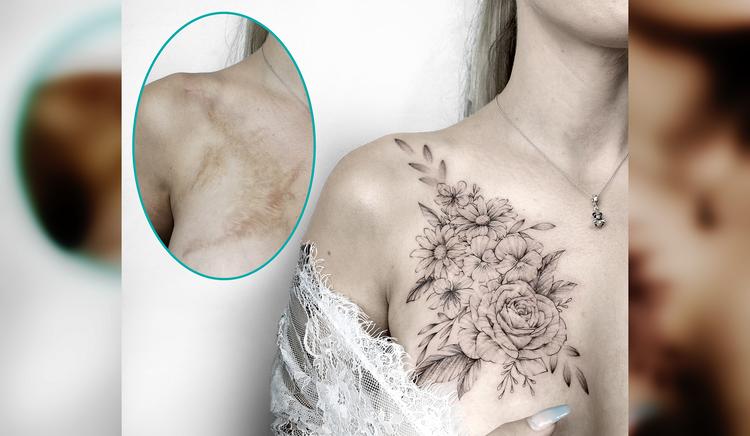 40 человек, которые использовали свои шрамы для создания уникальных татуировок