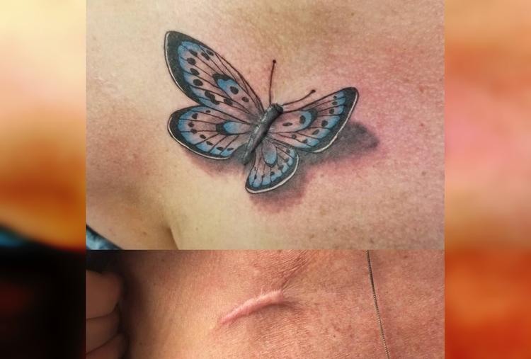 40 человек, которые использовали свои шрамы для создания уникальных татуировок
