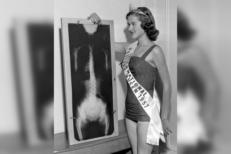 Top 25 Weirdest Beauty Contests of the Past