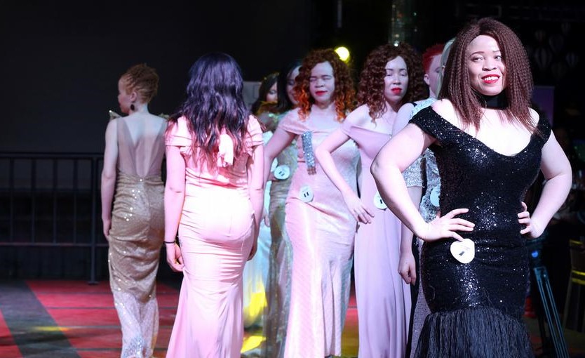 Beauty Beyond the Norm: Unconventional Pageants in Spotlight